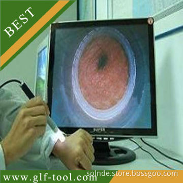 BEST-USB digital dermatologist magnifying glass
